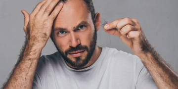 핀페시아 공식 직구몰: 안전하고 신뢰할 수 있는 탈모 치료의 첫걸음